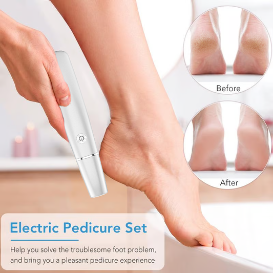 🔥 Hot Sale: 53% OFF Electric Callus Remover