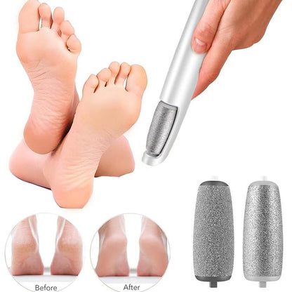 🔥 Hot Sale: 53% OFF Electric Callus Remover